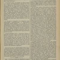 1059 - Page 1063 - Délire hypocondriaque et lésions organiques ; par MM. A. Rodiet et P. Dalmas... / Avis / Actualités. Quelques formes de la syphilis hépatique. [M. Brelet]