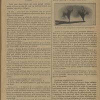 0085 - Page 77 - Un cas d'uretère double ayant, par néphrite douloureuse, simulé une affection hépatique ; par M. F. Ody