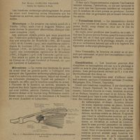 0150 - Page 146 - Revue générale. Les luxations métacarpo-phalangiennes du pouce en avant ; par Raoul Garling Palmer... / Historique / Mécanisme / Classification