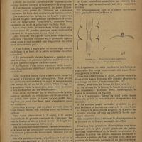 0169 - Page 165 - Flexion du colon ascendant et rétraction de la bandelette musculaire longitudinale ; par A. Chauvenet (de Thouars)
