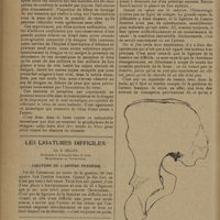 0278 - Page 276 - Recherches cliniques et étiologiques sur la fièvre dengue ; par E. Manoussakis... Mode de transmission de la dengue et sa prophylaxie / Les ligatures difficiles ; par H. Billet... Ligature de l'artère fessière