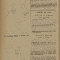 0300 - Page 298 - Un tout petit détail de technique en chirurgie plastique ; par George Pascalis / Sociétés savantes. Académie des sciences. (Séance du 11 février 1929). Appareils pour aveugles. M. Dussaud / La bio-énergétique et son nouveau laboratoire. M. J. Lefèvre / Académie de médecine. (Séance du 19 février 1929) / Mycétome du pied à grains blancs. MM. G. Delamare et C. Gatti / Influence de la vaccination antityphoïdique au cours d'une grave épidémie familiale de fièvre typhoïde. M. A. Lemierre