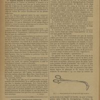 0446 - Page 444 - Fracture du cubitus avec luxation de la tête radiale. (Fracture de Monteggia) ; par M. Georges Leclerc... Les syphilitiques aux eaux minérales (Rapport de MM. Louis G. Blanc, Henri Flurin, Jean Heitz, Robert Pierret, Pierre Salles). Société d'hydrologie et de climatologie médicales de Paris. Séance solennelle annuelle du 18 mars 1929. [R. Levent] / Bulletin bibliographique / Actualités. Le lavage du poumon
