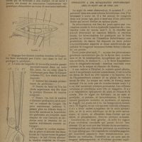 0484 - Page 482 - Un procédé de cure radicale de la hernie inguinale ; par André Folliasson... / Une observation de réaction méningée. Consécutive à une revaccination antivariolique chez un sujet âgé de vingt ans