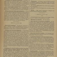 0530 - Page 528 - Sociétés savantes. Société de chirurgie. (Séance du 6 février 1929) / Traitement des pleurésies purulentes. M. Sauvé / Thérapeutique des ulcères gastro-duodénaux. M. Leriche. (Séance du 13 février 1929). Ulcères gastro-duodénaux. M. Métivet / Traitement des fractures du Dupuytren. M. Hartmann, sur ce travail de MM. Boppe et Vassitch / Arrachement du tronc du radial au niveau d'une plaie du coude et issue du fragment supérieur par une plaie de l'aisselle ; reposition ; suture ; guérison. M. Auvray, une observation de M. Jacques-Charles / Nouvelle méthode de stérilisation et de cicatrisation des plaies par électrolyse. M. Métivet, un travail de MM. Planque et Chevrier / La vaccination locale dans le cancer du col utérin. M. Hartmann, en son nom et au nom de Mme Aitoff / Présentations. M. Fredet / Election / (Séance du 20 février 1929). Goitre aberrant de la gouttière carotidienne. M. Le Normant, sur une observation de MM. Cornioley et Second / Invagination intestinale traitée par lavement baryté. M. Mouchet, une observation de M. Foucault / Duodénum mobile. M. Pierre Duval / Présentations. M. Grégoire