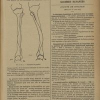 0665 - Page 663 - Deux cas de dystrophie osseuse de type particulier. Probablement liée à l'héredo-syphilis ; par MM. L. Babonneix... et P. Lonjumeau... / Sociétés savantes. Société de biologie. (Séance du 13 avril 1929). La chlorémie plasmatique et globulaire chez les néphrétiques azotémiques. M. Laudat / Chimiothérapie et moyens défensifs de l'organisme dans la guérison des manifestations syphilitiques expérimentales. MM. C. Levaditi, P. Lépine et A. Howard / L'encéphalo-myélite épidémique du renard. MM. C. Levaditi, P. Lépine et R. Schoen / Infection cholérique experimentale par voie intra-rachidienne. Essai de la vaccination locale de cavité méningée contre le vibrion cholérique. M. A. Urbain