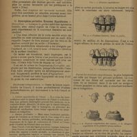 1316 - Page 1314 - Revue générale. Dystrophies dentaires. Leur valeur diagnostique ; par Ch. Ruppe... I. Dystrophies totales / II. Dystrophies partielles. Érosions. Hypoplasies / III. Dystrophies complexes