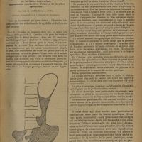 0969 - Page 961 - Ulcère gastrique avec niche chez un syphilitique avéré. Traitement d'épreuve. Disparition des signes fonctionnels. Persistance de la lésion anatomique. Gastrectomie consécutive. Examen de la pièce opératoire. Par MM. R. Leriche et A. Jung. (Clinique chirurgicale A de l'Université de Strasbourg)