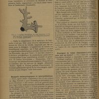 1342 - Page 1338 - Revue générale. Le lobe apical de la veine azygos ; par MM. Georges Carrière..., Louis Thomas... et Claude Huriez... II. Etude anatomique / III. Rappels embryologiques et interprétations / Pourquoi la veine rencontre-t-elle le poumon sur sa route ?