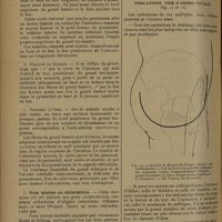 1486 - Page 1482 - Revue générale. Voies d'abord de l'articulation de la hanche ; par MM. A. Folliasson... et M. Joly... Technique des principales voies d'abord / Indications. Voie d'abord totale