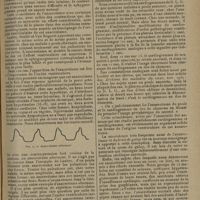 1667 - Page 1663 - Revue générale. L'anacrotisme ; par M. le Docteur Pierre Broustet. (Travail du laboratoire de physiologie de M. le Professeur Pachon). Mécanisme de l'anacrotisme