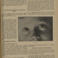 1931 - Page 1927 - Encéphalites infantiles ; par M. L. Babonneix...