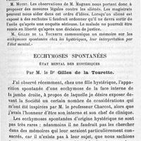 0091 - Page 91 - Société de médecine légale de France. Séance du 21 avril 1890. Présidence de M. Pouchet. Rapport médico-légal sur un persécuté homicide. Par M. Gibert Ballet. Ecchymoses spontanées. Etat mental des hystériques. Par M. le Dr Gilles de la Tourette