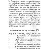 0420 - Page 396 - Extraction d'une pierre arrêtée à l'insertion de l'uretère dans la vessie, faite par M. Desault. Observation rédigée par M. Manoury. Explication de la planche I
