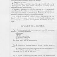 0131 - Page 126 - Revue générale. Des myomes cutanés, par Vincenzo Brigidi et Giorgio Marcacci. Explication de la planche II