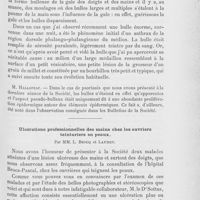 0147 - Page 143 - Société française de dermatologie et de syphiligraphie. À l'occasion du procès-verbal. Bulles des doigts par M. Barthélémy / Ulcérations professionnelles des mains chez les ouvriers teinturiers en peaux par MM. L. Brocq et Laubry