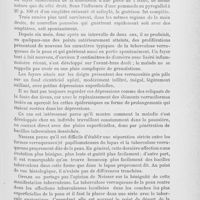 0811 - Page 799 - Revue des sociétés savantes. Breslauer dermatologische vereinigung. Séance du 16 juin 1900. Tuberculose verruqueuse de la peau / Lichen ruber plan atypique