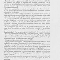 0893 - Page 889 - Analyses des principaux travaux reçus en juillet 1937. Un cas de Syndrome de Senear-Usher (Ein fall mit senear-usherschem syndrom), par R. Richter. Archiv für dermatologie und syphilis, 1937 / Maladie de swift-feer chez une personne adulte (Swift-feersche krankheit bei einer erwachsenen person), par F. Goldschlag et W. Stein. Archiv für dermatologie and syphilis, 1937