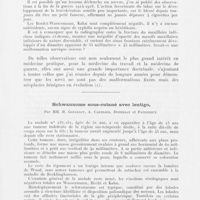 0093 - Page 91 - Société française de dermatologie et de syphiligraphie. Séance du 8 janvier 1942. Naevus papillomateux post-traumatique de la langue, de la face interne de la lèvre et de la joue avec leucokératose, par M. H. Gougerot / Schwannome sous-cutané avec lentigo, par Mm. H. Gougerot, A. Carteaud, Duperrat et Faugeroux