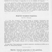 0096 - Page 94 - Société française de dermatologie et de syphiligraphie. Séance du 11 mars 1943. Présentation de malades. Pityriasis versicolor du dos des mains, par Mm. A. Touraine et G. Solente / Angiome encéphalo-trigéminé, par M. A. Touraine / Epiloïa ; tumeurs gingivales et vélo-palatines, par Mm. A. Touraine et P. Cernéa