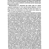 0510 - Page 501 - Revue générale. Obstétrique. Dystocie. / Hypertrophie et hydatides des reins chez un foetus (Dystocie causée par l') ; obs. par le docteur Oesterien