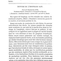 0419 - Page 419 - Mémoires originaux. Une épidémie de fièvre typhoïde au 102e de ligne à Courbevoie. Par le Dr L. Regnier... / Rupture de l'oesophage sain. Par le Dr Reginald H. Fitz... (Traduit de « American Journal, » janvier 1877, par le Dr G. Darin)