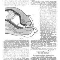 0068 - Page 64 - Revue générale. De la dilatation artificielle de l'orifice utérin pendant le travail. [H. Varnier]. / Travaux originaux. La désinfection d'une ville pestiférée au XVIIe siècle, par M. le Dr de Santi