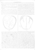 Fig. 58 / Fig. 59 [De la situation des oeufs et des foetus dans la grossesse gémellaire et des sympt [...]