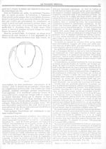 Fig. 65 [De la situation des oeufs et des foetus dans la grossesse gémellaire et des symptômes qui e [...]