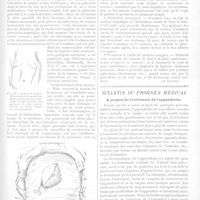 0280 - Page 277 - Médecine opératoire. De l'hépatectomie. (Revue générale). Par J. Pantaloni... (A suivre.) / Bulletin du progrès médical. A propos du traitement de l'appendicite
