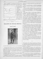 Fig. 6. Obs. VIII. - Radiographie 10 janvier 1917 / La mort du médecin auxiliaire Decreuse au Vieil- [...]