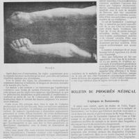 0324 - Page 310 - Faits cliniques. Adipose douloureuse et lipomatose symétrique, par M. Bourdinière... / Bulletin du progrès médical. L'épilepsie de Dostoiewsky