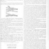 0082 - Page 75 - Faits cliniques. Contribution à l'étude du mécanisme des fractures de l'extrémité inférieure du radius par retour de manivelle non lâchée. Par le Médecin-major de 1re classe Duméry / Sociétés savantes. Académie de médecine. Séance du 8 février 1921