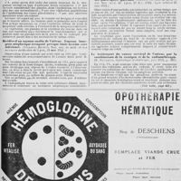 0429 - Page 435 - Actualités médicales. Cancer de l'utérus. Adénomes bénins du corps utérin u type décidual, (Kano Moukayé, Gynécologie et obstétrique, 1921, tome III, page 233) / Récidive d'un myome malin de l'utérus. Enorme bourgeon néoplasique occupant presque toute la veine cave inférieure (Villard, Michon, Soc. nat. de med. et des sciences médicales de Lyon, 25 mai 1921) / Cancer du col utérin propagé au vagin; radiumthérapie des masses vaginales: hystércetomie abdominale dix jours après: guérison (Violet, Soc. nat. de méd. et des Soc. méd. de Lyon, 16 fév. 1921, Lyon médical 25 mai 1921) / Le traitement du cancer cervical de l'utérus par la combinaison de la roentgen et de la radiumthérapie (S. Recasens, Gynécologie et obstétrique, juin 1921...) (Voir suite, page 437)