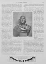 Civiale. (Buste marbre par Chaput.) - Le progrès médical