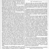 0561 - Page 559 - La contagion de la phthisie pulmonaire. Suite et fin. - Voir les numéros 43, et 44. [J. Arnould]. / Dermatologie. De l'érythème polymorphe exsudatif (ou maladie d'Hébra), par le docteur Paul Fabre... Suite. - Voir les numéros 41, 42 et 44