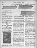 Fig. 162. Suture en surjet / Fig. 163. Suture en chaînette / Fig. 164. La même, vue par la face oppo [...]