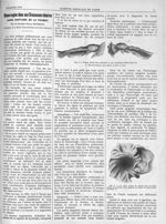 Fig. 1. Trompe droite ; face antérieure et face postérieure (Observation II) / Fig. 2. La paroi prop [...]