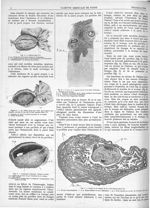 Fig. 3 (Observation IV.) / Fig. 4. La même pièce que celle de la figure précédente, ouverte et vue p [...]