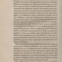 0052 - Page 52 - Appréciation de la méthode