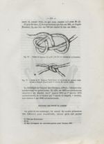 Fig. 16. Noeud de Leyman, tel qu'il a dû être au moment de sa formation / Fig. 17. Noeud de W. Newma [...]