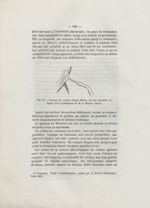 Fig. 18. Torsion du cordon, d'après Blume, cité par Schroeder. Figure due à l'obligeance de M. G. Ma [...]