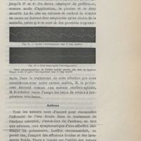 0215 - Page 199 - Asthme