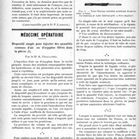 0863 - Page 864 - Partie scientifique. Clinique chirurgicale, Hôpital Necker : M. le professeur Legueu. III, Un cas de suture de l’uretère / Médecine opératoire. Dispositif simple pour injecter des quantités connues d’air ou d’oxygène filtrés dans la plèvre, par le Dr A. Challamel
