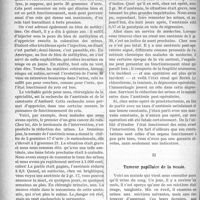 1303 - Page 1306 - Partie scientifique. Clinique chirurgicale, Hôpital Necker : M. le professeur Legueu. I, Calculs du rein. Urémie aiguë post-opératoire / II, Tumeur pupillaire de la vessie