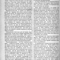 0789 - Page 788 - Actualités médicales. Laryngologie. Injections intra-trachéales, sans miroir, à l’aveugle / Injections intra-trachéales directes, par ponction inter-crico-thyroïdienne