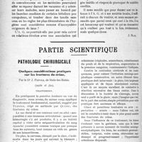 1293 - Page 1292 - Propos du jour. A propos dc l’Assemblée Générale de l'Association des Médecins de France [J. Noir] / Partie scientifique. Pathologie chirurgicale. Quelques considérations pratiques sur les fractures du crâne, par le Dr J. Fievez, (suite et fin)