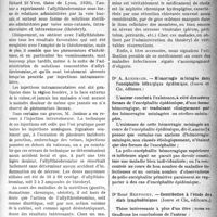 0900 - Page 899 - Partie scientifique. Bibliographie critique. Revue des Thèses. Thèse de Paris. L’allylthéobromine, par Dr A. Jouisse; 1920 / Hémorragie méningée dans l’encéphalite léthargique épidémique, par Dr A. Auerbach, (Jouve et Cie, éditeurs) / Contribution à l’étude des états lymphadéniques, par Dr René Hervouet, (Jouve et Cie, éditeurs)