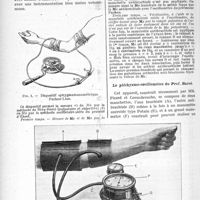 2681 - Page 2674 - Partie scientifique. La pression artérielle. Les sphygmomanomètres mixtes et les sphygmomanomètres graphiques, par le Dr Camille Lian. Les sphygmomanomètres mixtes. Le dispositif Pachon-Lian / Le pléthysmo-oscillomètre du Prof. Barré