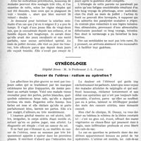 0171 - Page 268 - Partie scientifique. Travaux Originaux. Ophtalmologie. Procédé simple pour le diagnostic des paralysies des muscles de l’oeil, par le Dr A. Bourgeois / Gynécologie, M. le Professeur J. -L. Faure. Cancer de l’utérus : radium ou opération ? [Leçon recueillie par le Dr P. Lacroix]